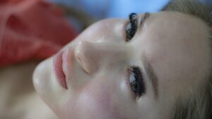 ニキビに悩むあなたへ、スキンケアと皮膚科からのアドバイスは？