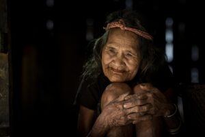 ニキビが潰れた直後の正しいケア方法は？