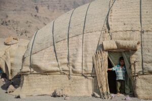 フォトフェイシャルはニキビにどれほどの効果があるのか？