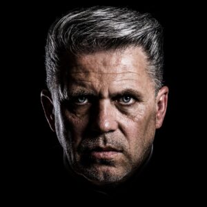 黄ニキビを潰した後の正しいケア方法は？